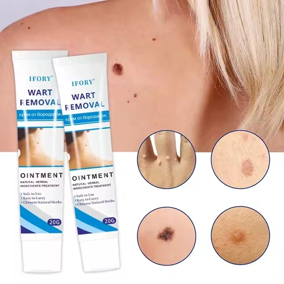 Wart Removal Ointment